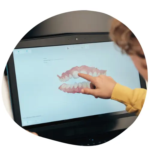 Digitale Behandlungsplanung am 3D-Modell